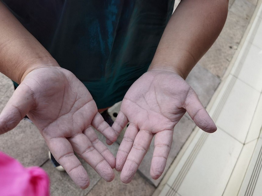 �t(y��)�o(h��)�ˆT����ˮ�ݵðl(f��)�����֡�����^(q��)�l(w��i)��ί���D